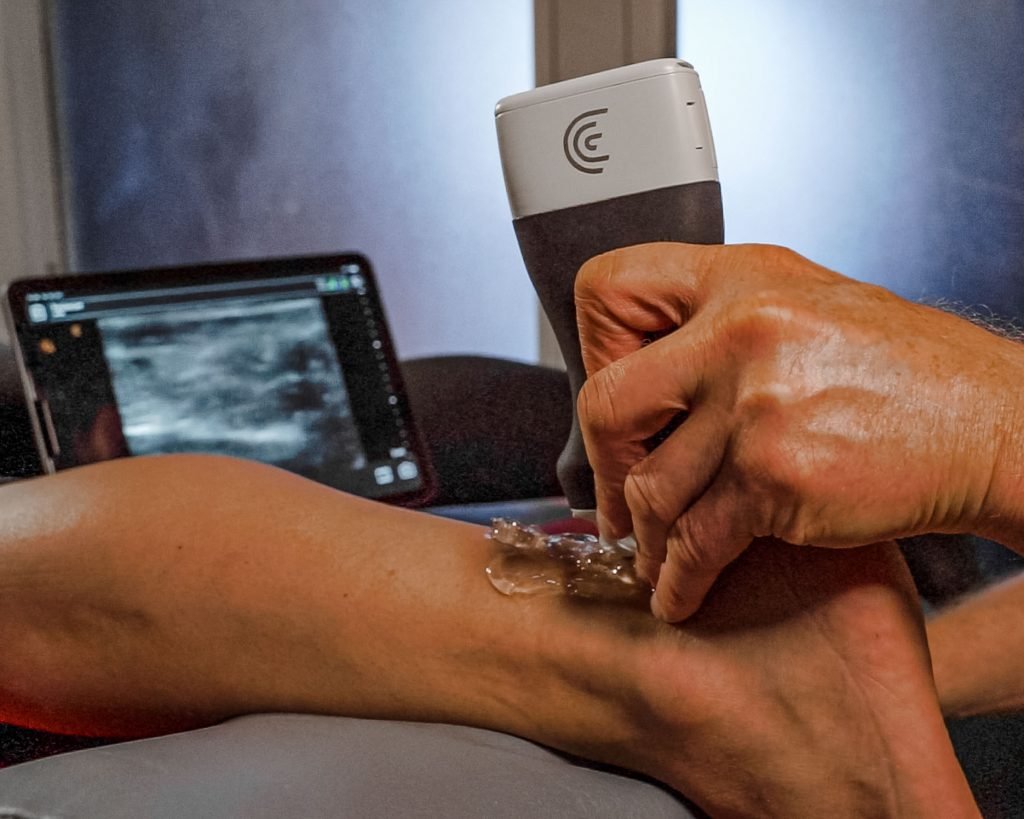 Diagnostiskt ultraljud fysioninwest